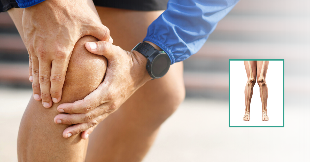 Surgical Technique Used in Knock Knee Surgery